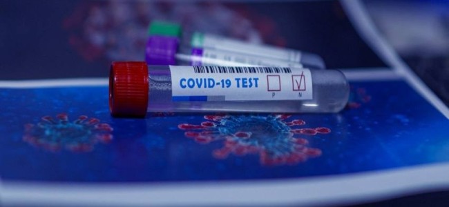 63 new COVID-19 cases in J&K