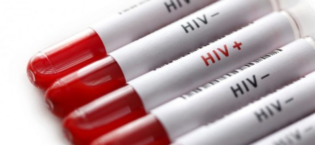 Record three in five HIV-carriers now have access to drugs, says UN